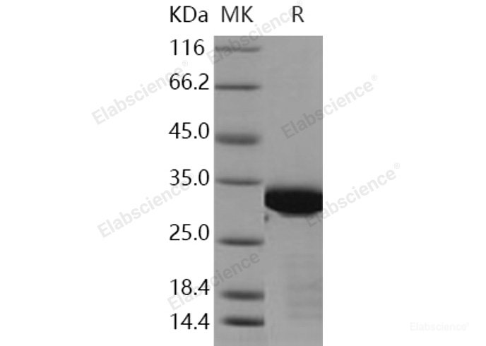 Recombinant Human BCL6 / B-cell CLL lymphoma 6 Protein (aa 1-150, His & Trx tag)-Elabscience