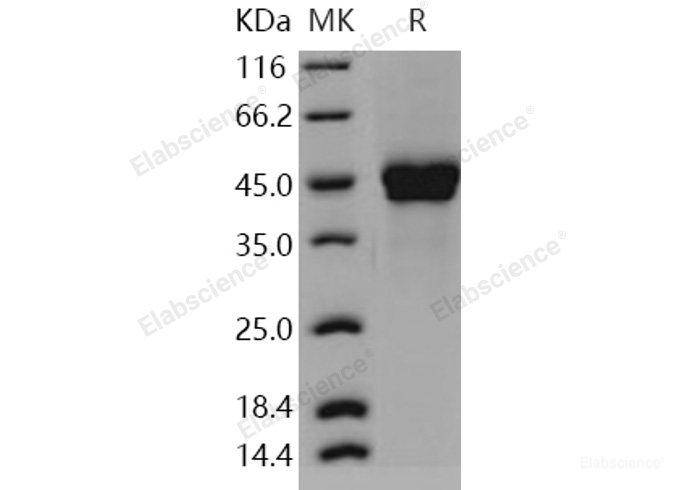 Recombinant Human PTX3 / Pentraxin 3 / TSG-14 Protein (His tag)-Elabscience