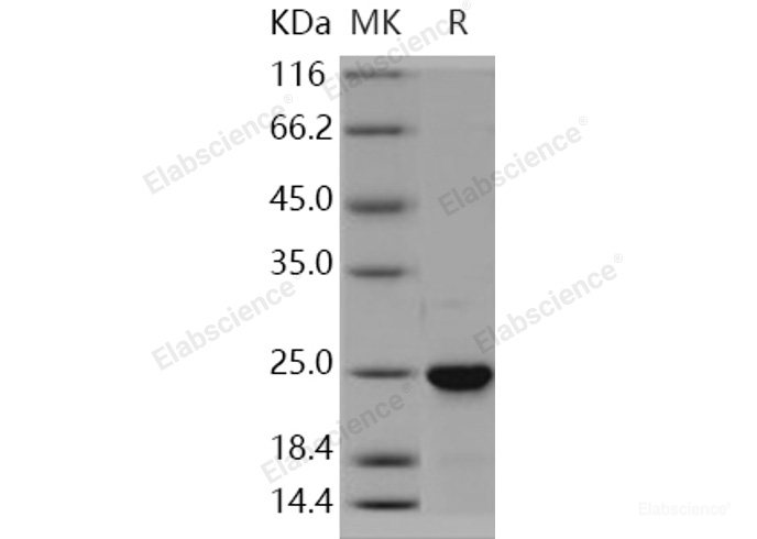 Recombinant Human NRAS Protein (His tag)-Elabscience
