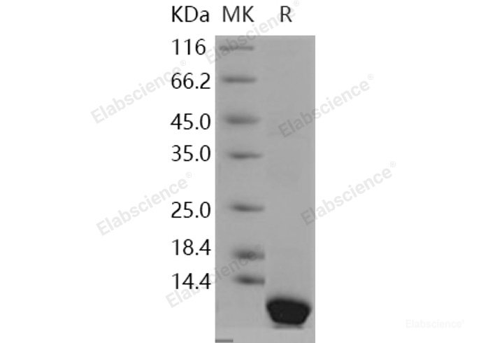 Recombinant Human Pepsinogen C / PGC Protein (His tag)-Elabscience