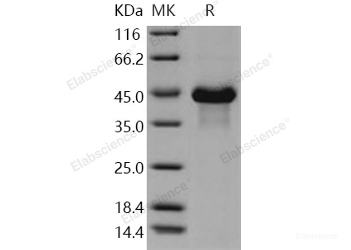 Recombinant Human VWC2 / Brorin Protein (His tag)-Elabscience