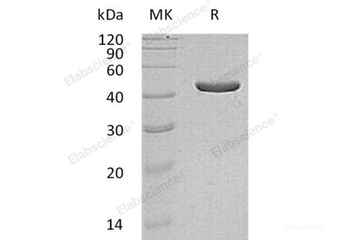 Recombinant Human Isocitrate dehydrogenase Protein (His Tag)-Elabscience