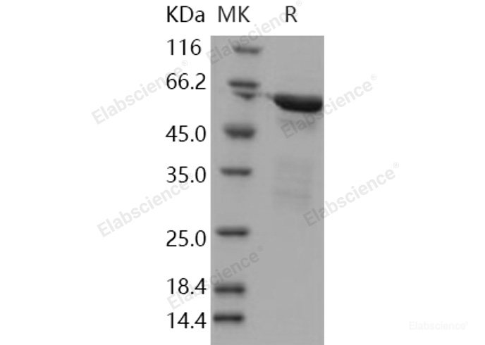 Recombinant Human RELA / Transcription factor p65 / NFkB p65 Protein (aa 1-306, GST tag)-Elabscience