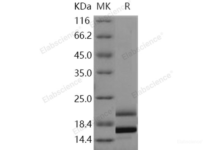 Recombinant Human IL17 / IL17A Protein (His tag)-Elabscience