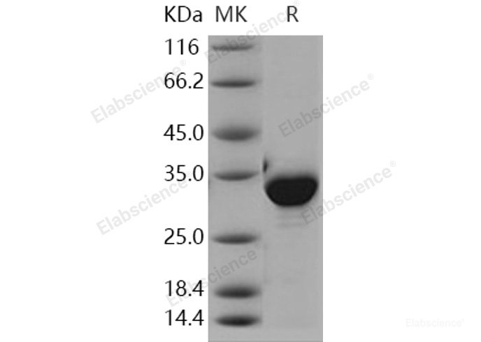 Recombinant Human NQO1 / DT-diaphorase Protein (His tag)-Elabscience