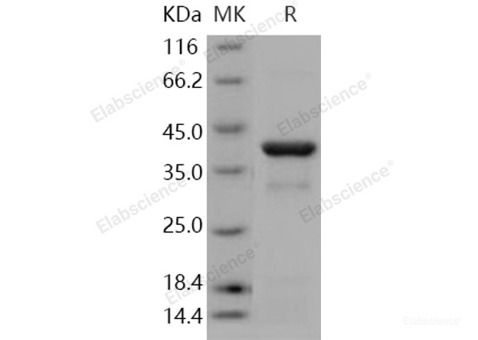 Recombinant Human IKB alpha / NFKBIA Protein (His tag)-Elabscience