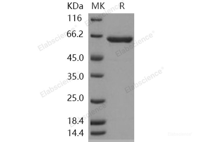 Recombinant Human Hexosaminidase A / HEXA Protein (Subunit A, His tag)-Elabscience