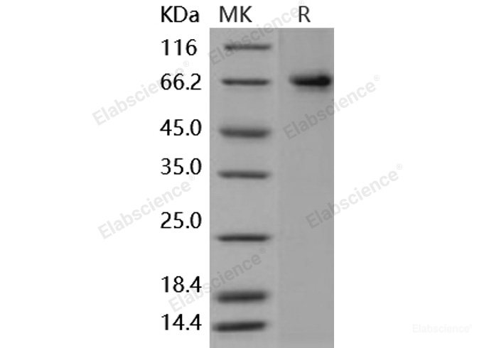 Recombinant Human PTGS2 / COX2 / PGHS-2 Protein (His tag)-Elabscience
