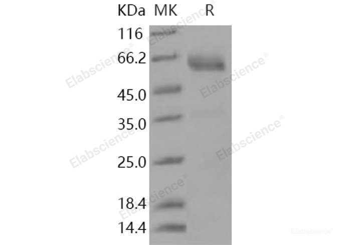 Recombinant Human SMOC1 Protein (His tag)-Elabscience