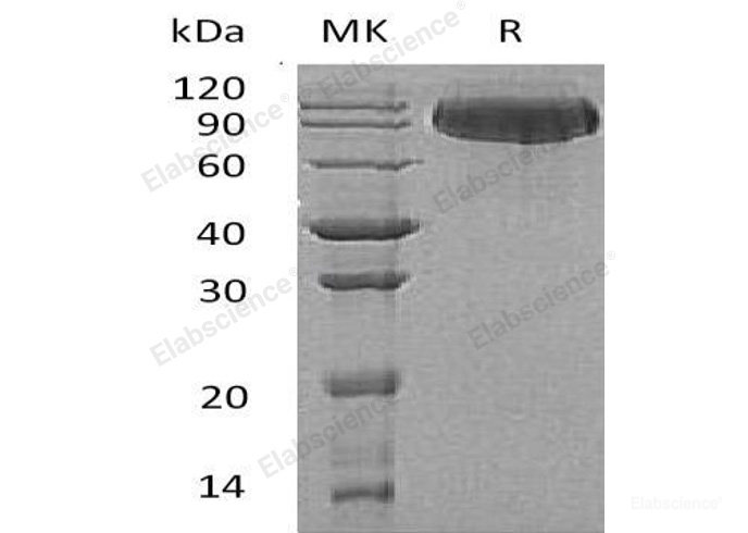 Recombinant Human Butyrylcholinesterase Protein (His Tag)-Elabscience