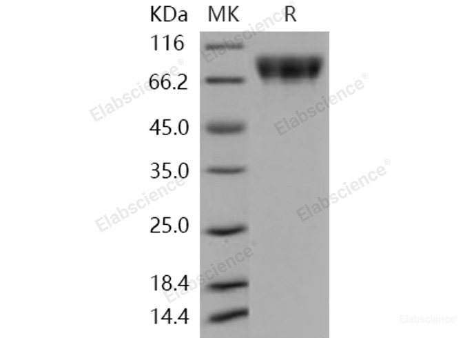 Recombinant Human c-KIT / CD117 Protein (His tag)-Elabscience