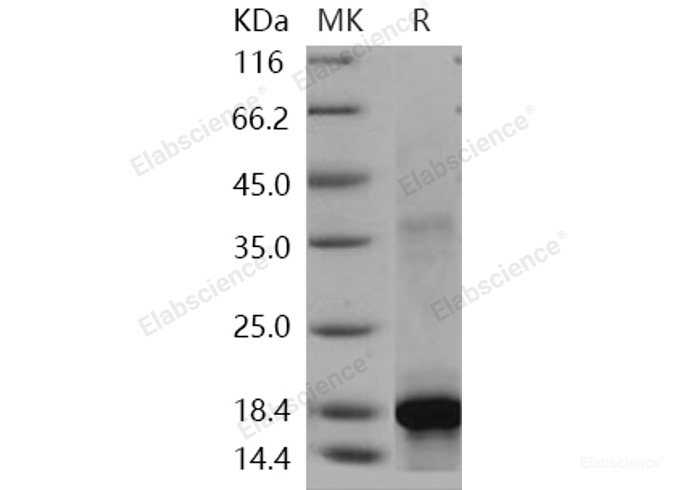 Recombinant Human KIT / c-KIT / CD117 Protein (aa 50-190, His tag)-Elabscience