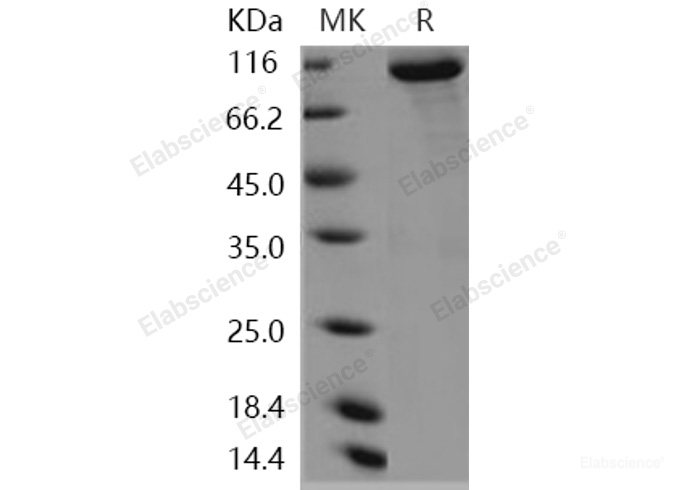 Recombinant Human KEAP1 / INRF2 Protein (His & GST tag)-Elabscience