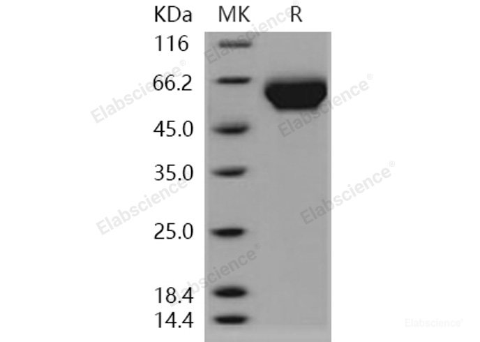 Recombinant Human LILRB3 / LIR3 / ILT5 / CD85a Protein (His tag)-Elabscience