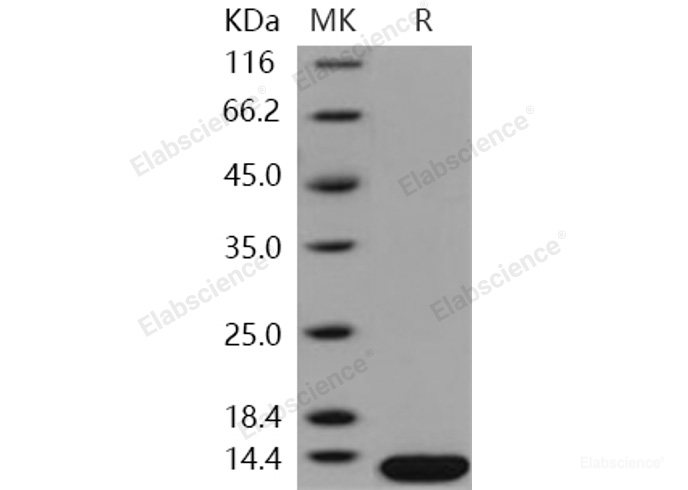 Recombinant Human B2M / Beta-2-microglobulin Protein (His tag)-Elabscience
