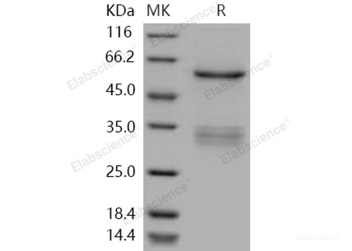 Recombinant Human SUV420H2 Protein (His & GST tag)-Elabscience