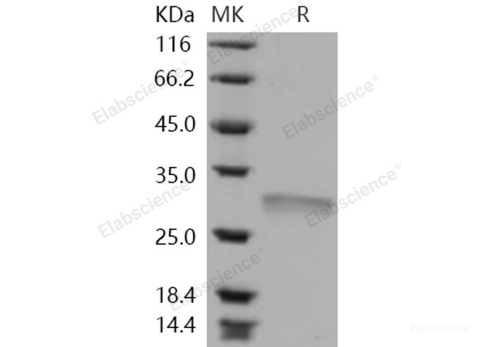 Recombinant Human RPE / RPE2-1 Protein (His tag)-Elabscience