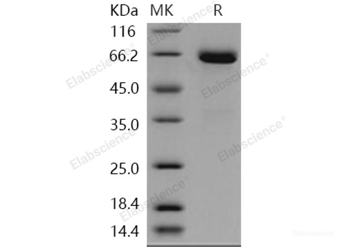 Recombinant Human EphB1 / EPHT2 Protein (His tag)-Elabscience