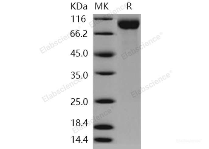 Recombinant Human Siglec-2 / CD22 Protein (aa 176-687, His tag)-Elabscience