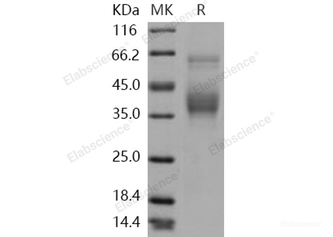 Recombinant Human SLAMF6 / Ly108 Protein (His tag)-Elabscience