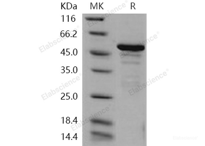 Recombinant Human ANP32A / PHAP1 Protein (His & GST tag)-Elabscience