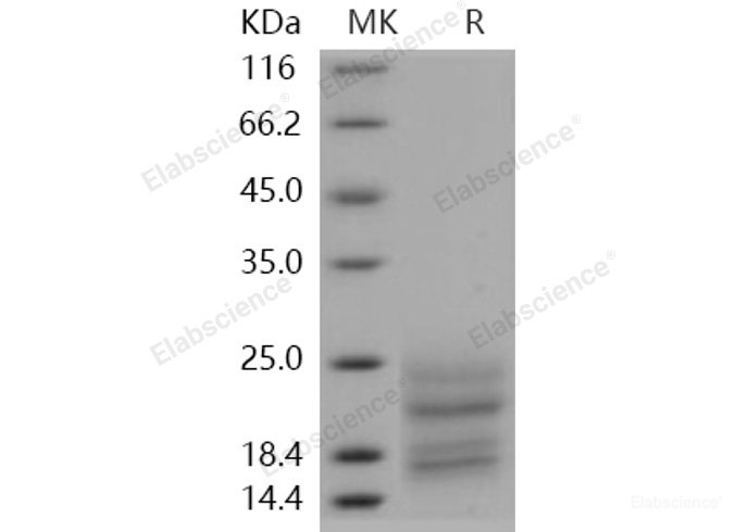 Recombinant Human TNFRSF13B / TACI / CD267 Protein (His tag)-Elabscience