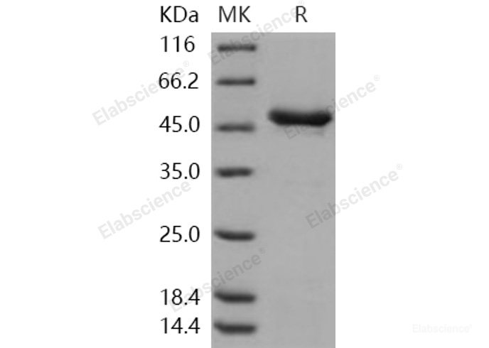 Recombinant Human Tryptophan Hydroxylase 1 / TPH1 Protein (His tag)-Elabscience