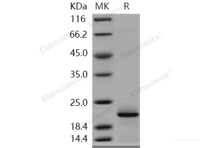 Recombinant Human Complexin-2 / CPLX2 Protein (His tag)-Elabscience