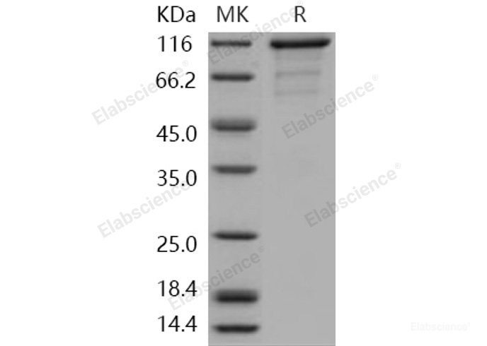 Recombinant Human CASK Kinase Protein (His & GST tag)-Elabscience
