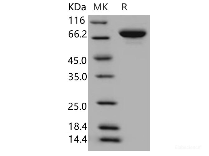 Recombinant Human XPNPEP2 Protein (His Tag)-Elabscience