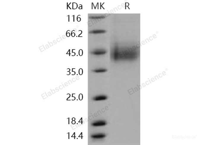 Recombinant Human CLEC12A / CLL-1 / DCAL2 Protein (His tag)-Elabscience
