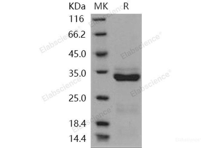 Recombinant Human Trypsin-3 / PRSS3 Protein (His tag)-Elabscience