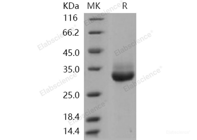 Recombinant Human KLK-4 / Kallikrein-4 Protein (His tag)-Elabscience