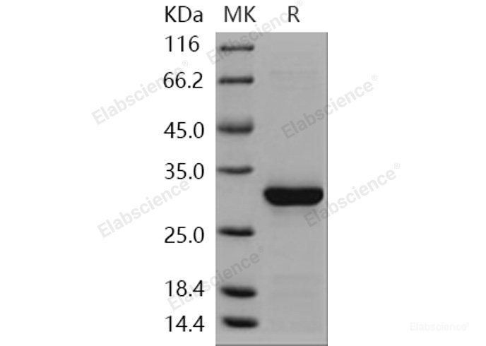 Recombinant Human Caspase-14 / CASP14 Protein (His tag)-Elabscience