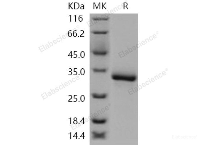 Recombinant Human XEDAR / EDA2R Protein (His tag)-Elabscience