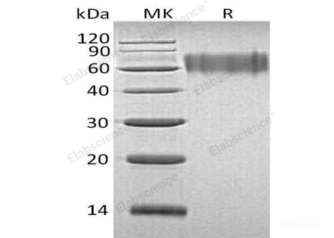 Recombinant Human LYPD3 Protein (His Tag)-Elabscience