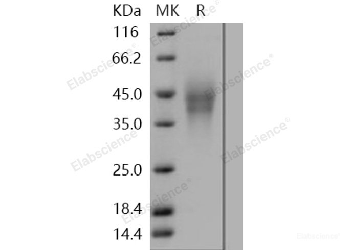Recombinant Human CD300C / CMRF-35 / IGSF16 Protein (His tag)-Elabscience