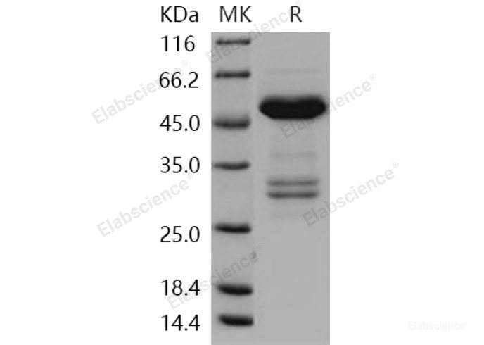 Recombinant Human TWF1 / PTK9 / Twinfilin-1 Protein (His & GST tag)-Elabscience