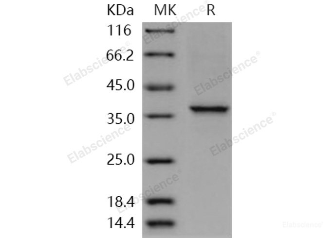 Recombinant Human COL2A1 Protein (aa 1242-1487, His tag)-Elabscience