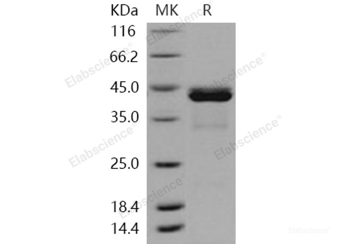 Recombinant Human CALML5 / CLSP Protein (His & GST tag)-Elabscience