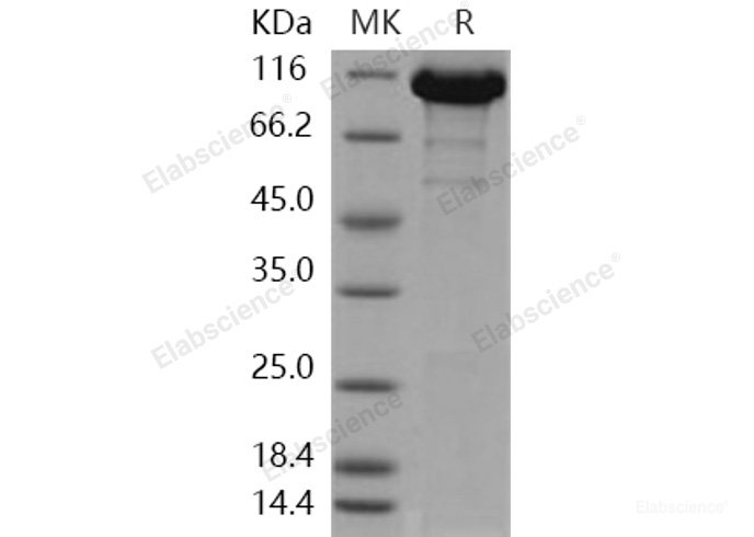 Recombinant Human ACLY / acly / ATP citrate lyase Protein (His tag)-Elabscience