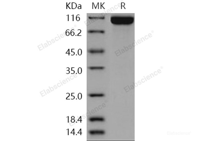 Recombinant Human DPP10 / DPRP3 Protein (His tag)-Elabscience