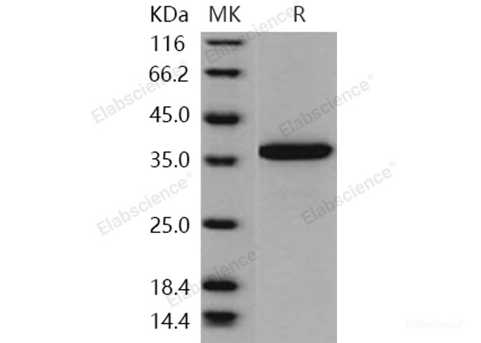 Recombinant Human PDE9A Protein (His tag)-Elabscience