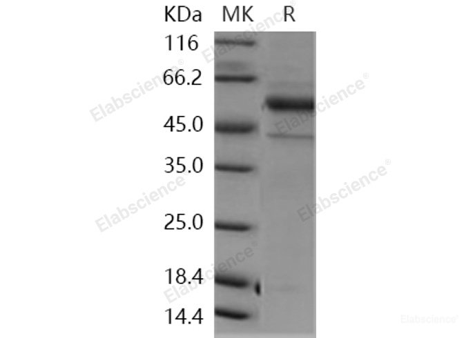 Recombinant Human NTPDase 2 / ENTPD2 Protein (aa 29-460, His tag)-Elabscience