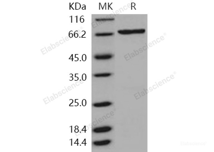 Recombinant Human SGK3 / SGKL Protein (His & GST tag)-Elabscience
