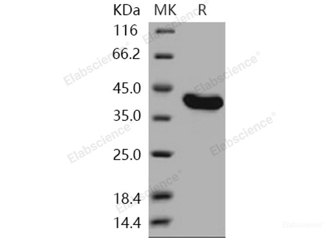 Recombinant Human USP7 / HAUSP Protein (aa 208-560)-Elabscience