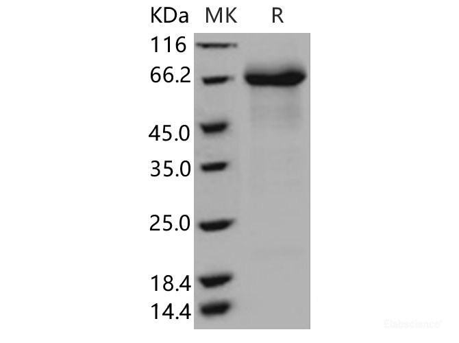 Recombinant Human IL12RB1 Protein (His Tag)-Elabscience