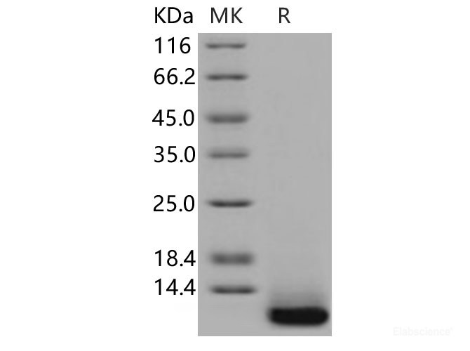 Recombinant Human SPINK4 Protein (His Tag)-Elabscience