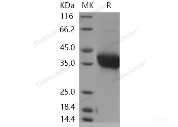 Recombinant Human ADM / Adrenomedullin Protein (Fc tag)-Elabscience