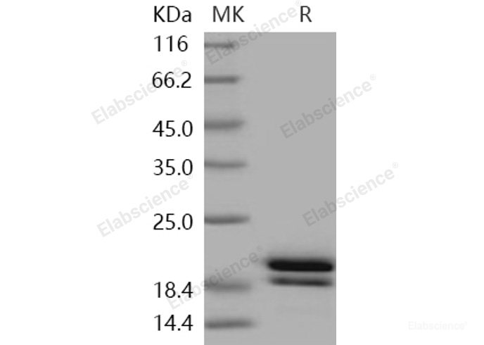 Recombinant Human REG1B / PSPS2 Protein (His tag)-Elabscience